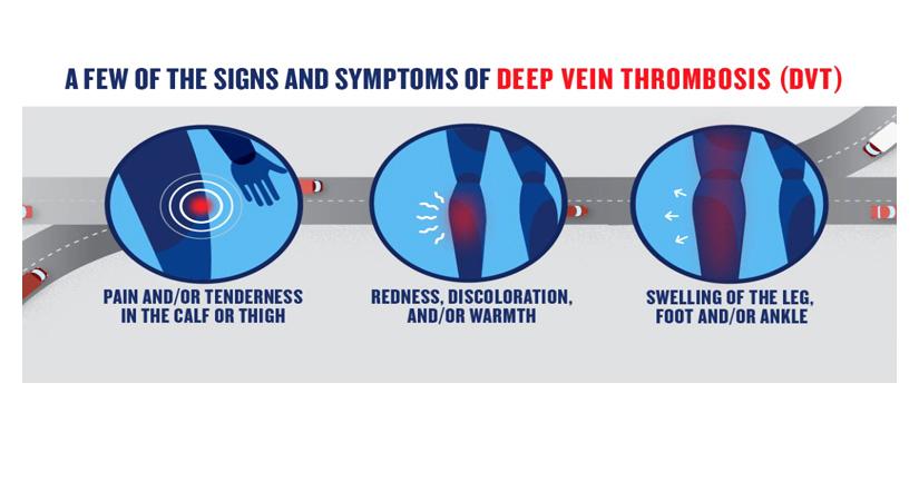 Signs and symptoms_Thrombosis