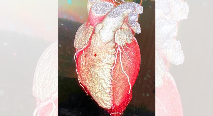 Bollywood heartthrob Hrithik Roshan has shared the shape of his heart! Hrithik, popularly called the Greek God of Hindi films took to Instagram to share a picture of a human heart. He captioned it: "The shape of my heart.. Literally. How vulnerable we all are. Wish we didn't need to spend more than half our lives unconsciously trying so hard to be loved by everyone all the time. So easily we forget that we are all the same..Made of love.".