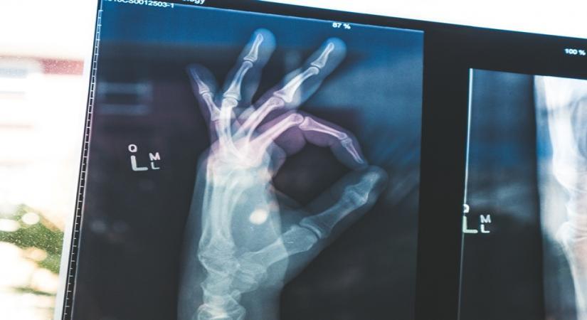 6 signs of protein deficiency