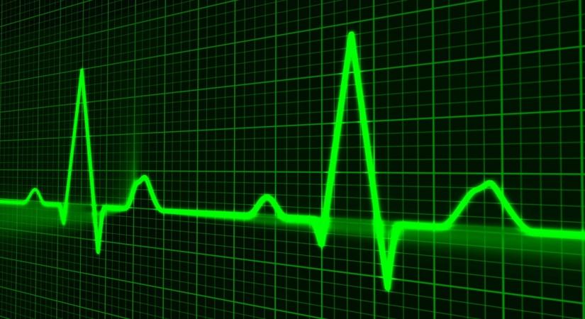 Researchers have revealed that women's heart attack symptoms are not all that different, adding that the top three heart attack symptoms in both women and men are chest pain, sweating, and shortness of breath.