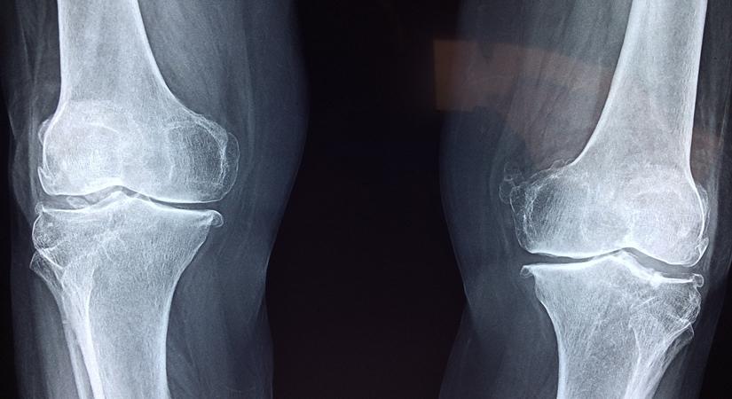 Dealing with orthopedic problems during lockdown