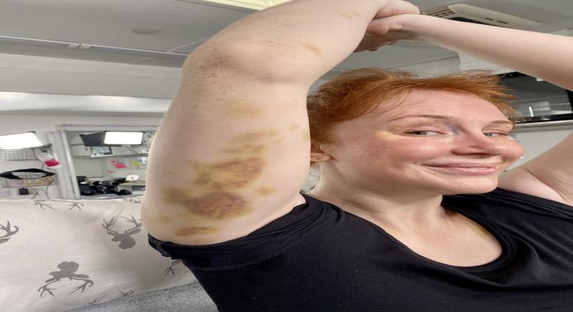 Bryce Dallas Howard bruised while filming 'Jurassic World: Dominion'. (Photo: Sugandha Rawal IANS)