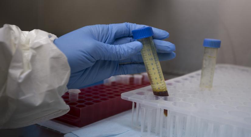 New York, Aug 8 (IANS) Opening clinics dedicated to treating influenza can limit the number of infected people and help to flatten the curve or reduce the peak prevalence rate, say researchers.