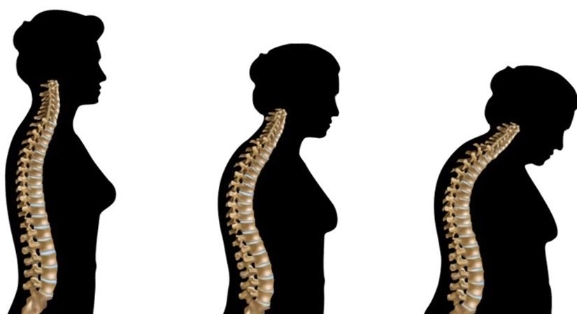 Women who perform domestic chores have better bone health