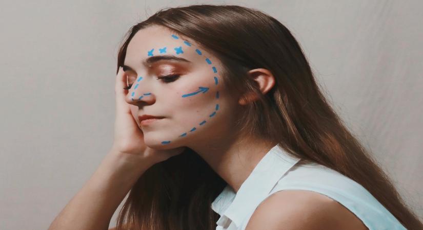 Things to consider before undergoing face upliftment surgery