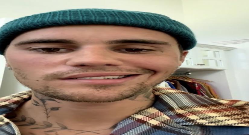 Justin Bieber struck with facial paralysis