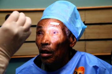 The ability of cataract surgery to restore sight is well known and a new study suggests that it can make people 48 per cent safer on the road. (Xinhua/Sunil Sharma/IANS)