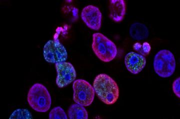 Representative Image, Source: Unsplash