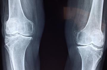 Dealing with orthopedic problems during lockdown