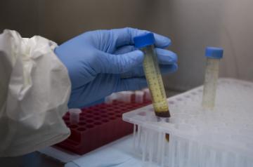 New York, Aug 8 (IANS) Opening clinics dedicated to treating influenza can limit the number of infected people and help to flatten the curve or reduce the peak prevalence rate, say researchers.