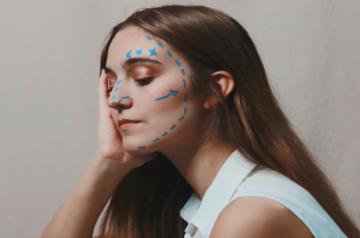 Things to consider before undergoing face upliftment surgery